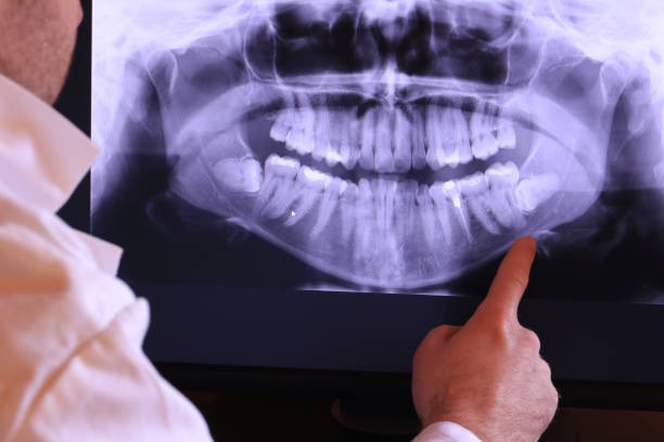 Best Emergency Treatment for Dental Infections or Abscesses in East Pittsburgh, PA